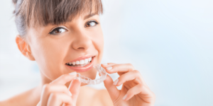 Invisalign: The Social-Media-Friendly Orthodontic Procedure